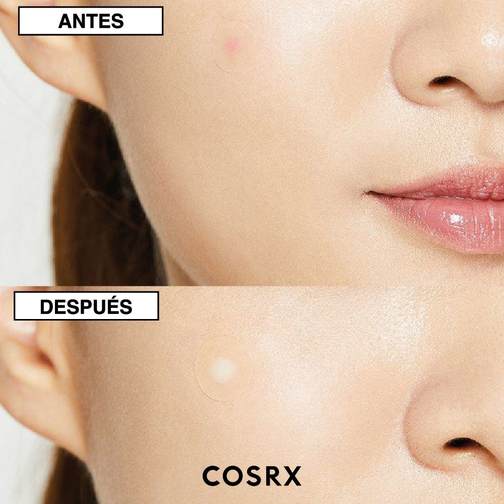 ACNE SIMPLE MASTER PATCH COSRX PARCHES X 24 UNDS