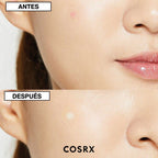 ACNE SIMPLE MASTER PATCH COSRX PARCHES X 24 UNDS