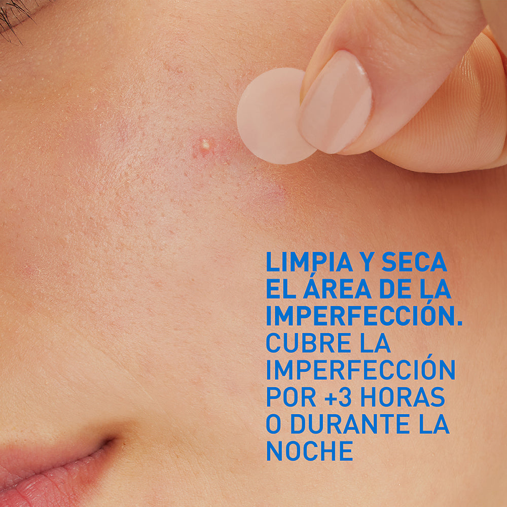 CERAVE PARCHES CONTROL IMPERFECCIONES CAJA X 22 UNDS