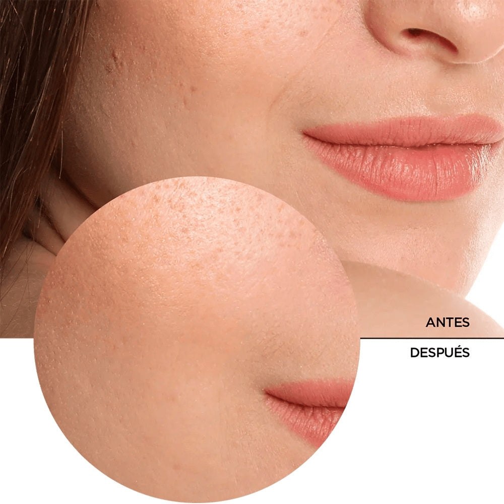 REVOX ACIDO HIALURONICO SERUM 5% FRASCO GOTERO 30 ML