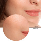 REVOX ACIDO HIALURONICO SERUM 5% FRASCO GOTERO 30 ML