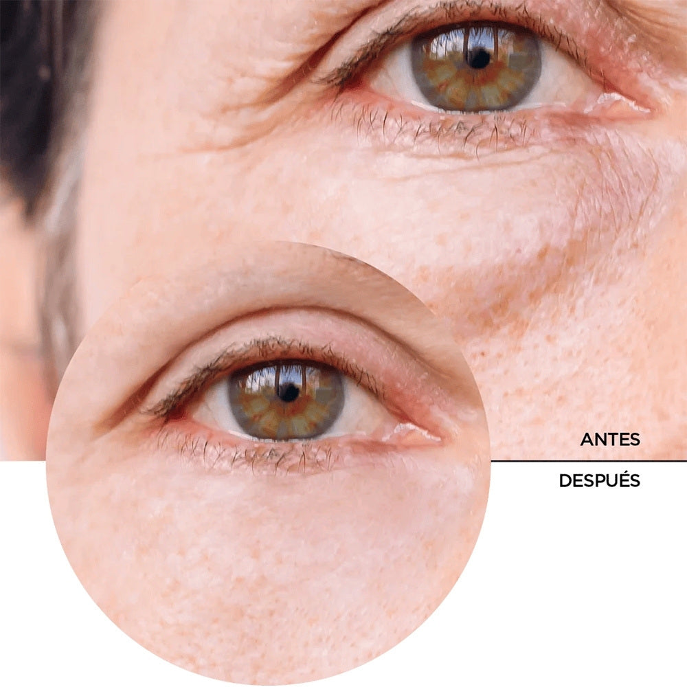 REVOX CONTORNO DE OJOS CAFEÍNA SERUM 5% FRASCO GOTERO 30 ML