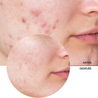 REVOX NIACINAMIDA SERUM 10 % FRASCO GOTERO 30 ML