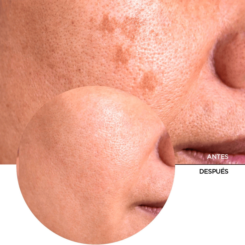 REVOX VITAMINA C SERUM 20% FRASCO GOTERO 30 ML