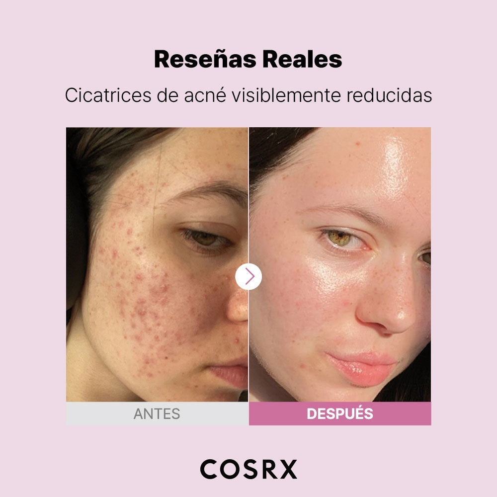 THE NIACINAMIDE 15 COSRX SERUM FRASCO 20 ML