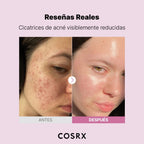THE NIACINAMIDE 15 COSRX SERUM FRASCO 20 ML
